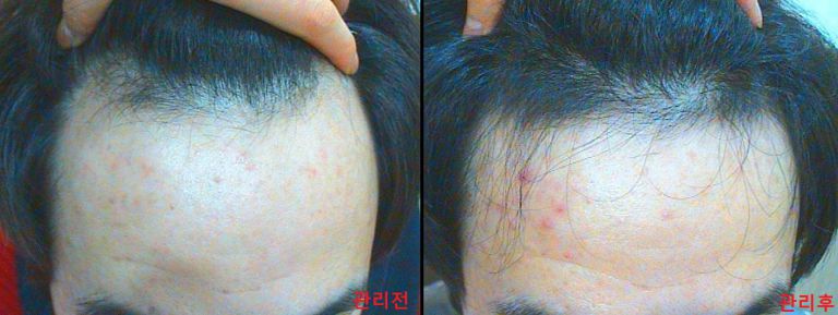 임상사진